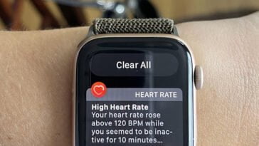 Hey Siri, What Happened? 11 iwatch